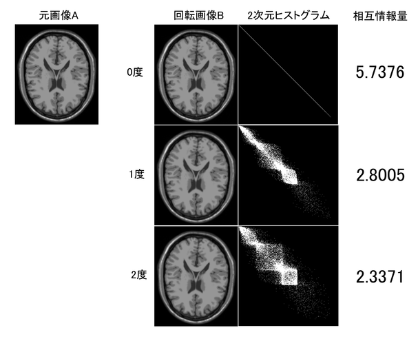 医用画像位置合わせの基礎 Amazon.co.jp: 医用画像位置合わせの基礎 : 篠原 広行, 伊藤 猛