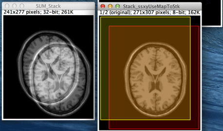 医用画像位置合わせの基礎④ 〜LPixel ImageJ pluginを用いた