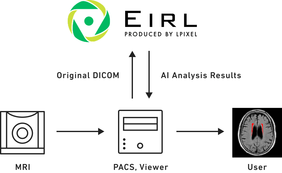 Eirl Brain Metry システム連携